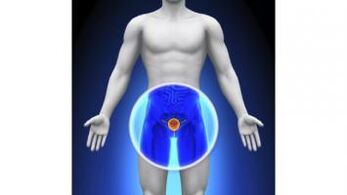 Prostatitis bei einem Mann