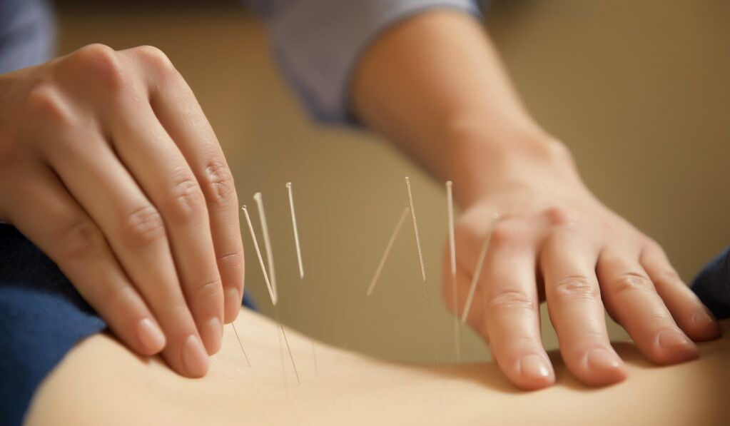 Akupunktur ist eine gängige Methode zur Behandlung chronischer Prostatitis.